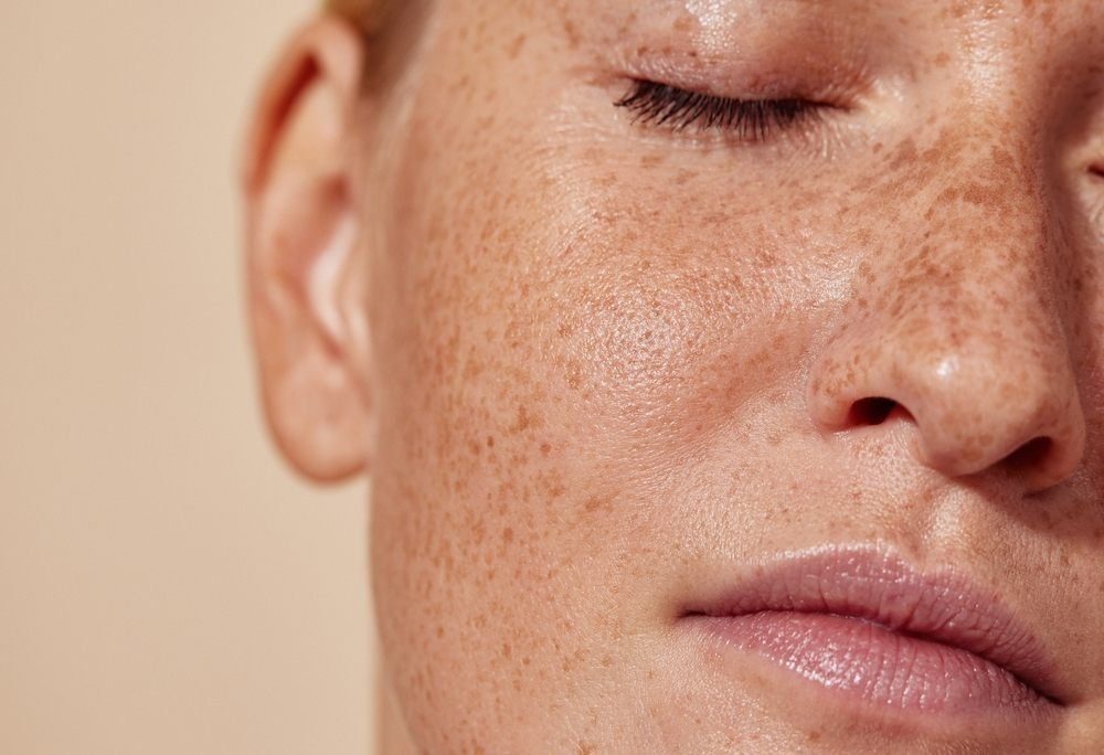 Gros plan sur la texture naturelle de la peau et ses taches de rousseur